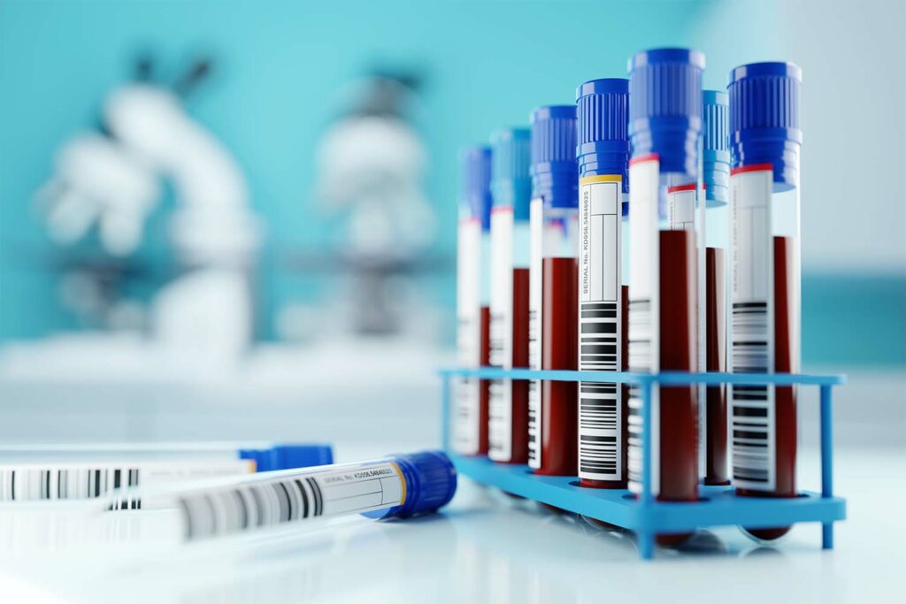 Where Is Whole Blood for Testing in a Clinical Laboratory Collected From?