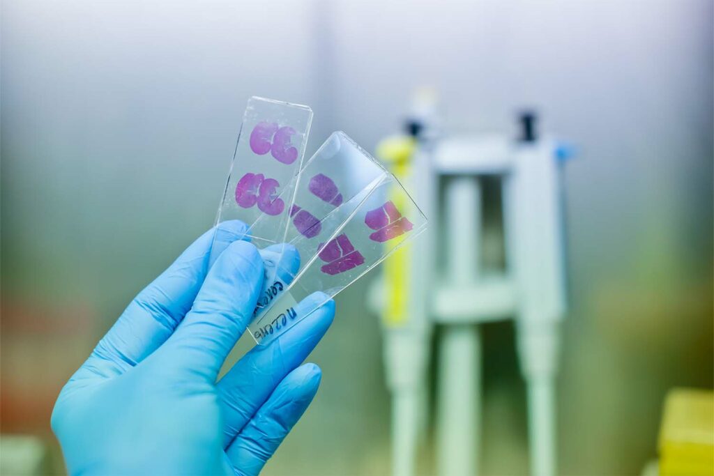 How To Find Cost-Effective Tissue Samples