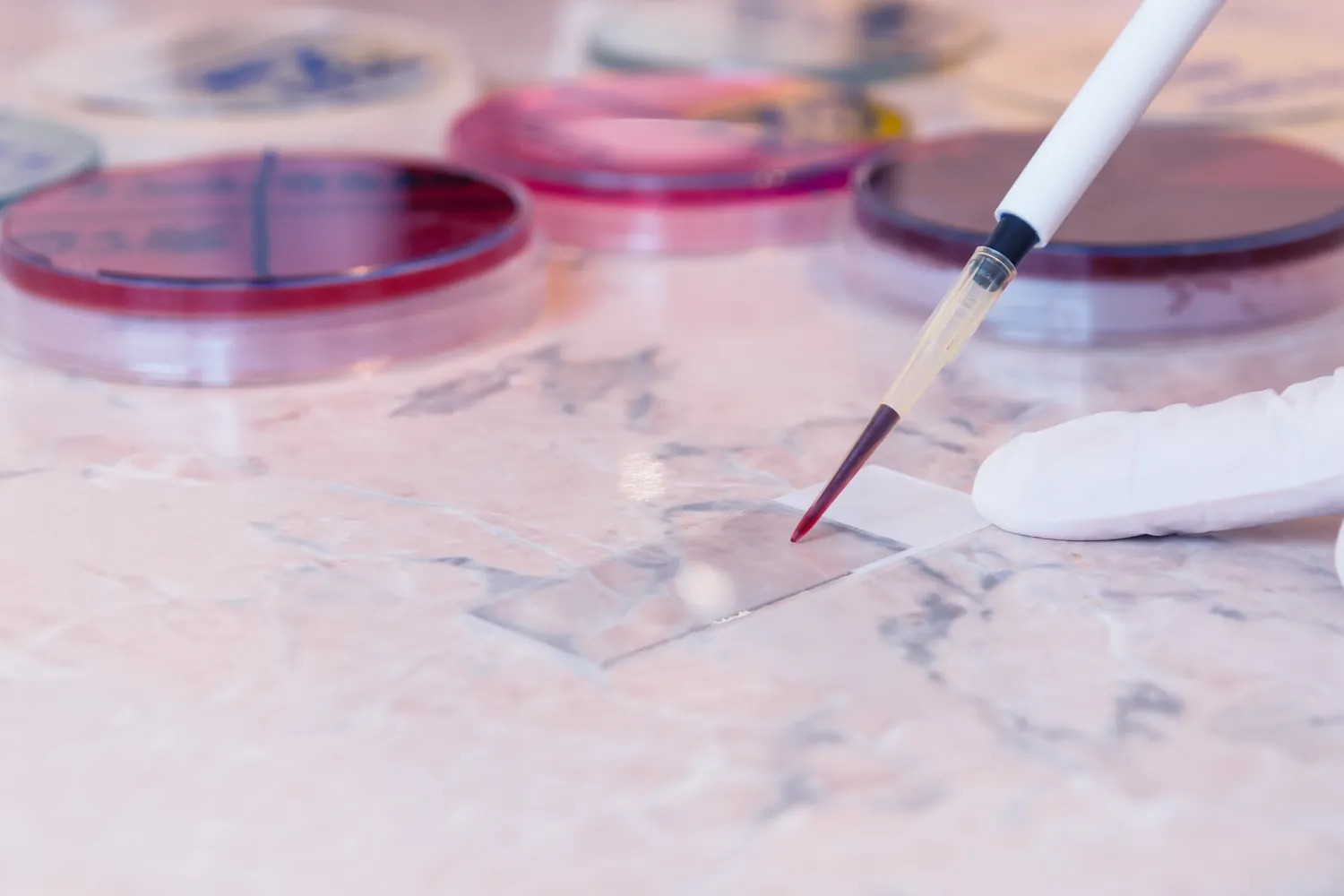 Peripheral Whole Blood vs. PBMCs